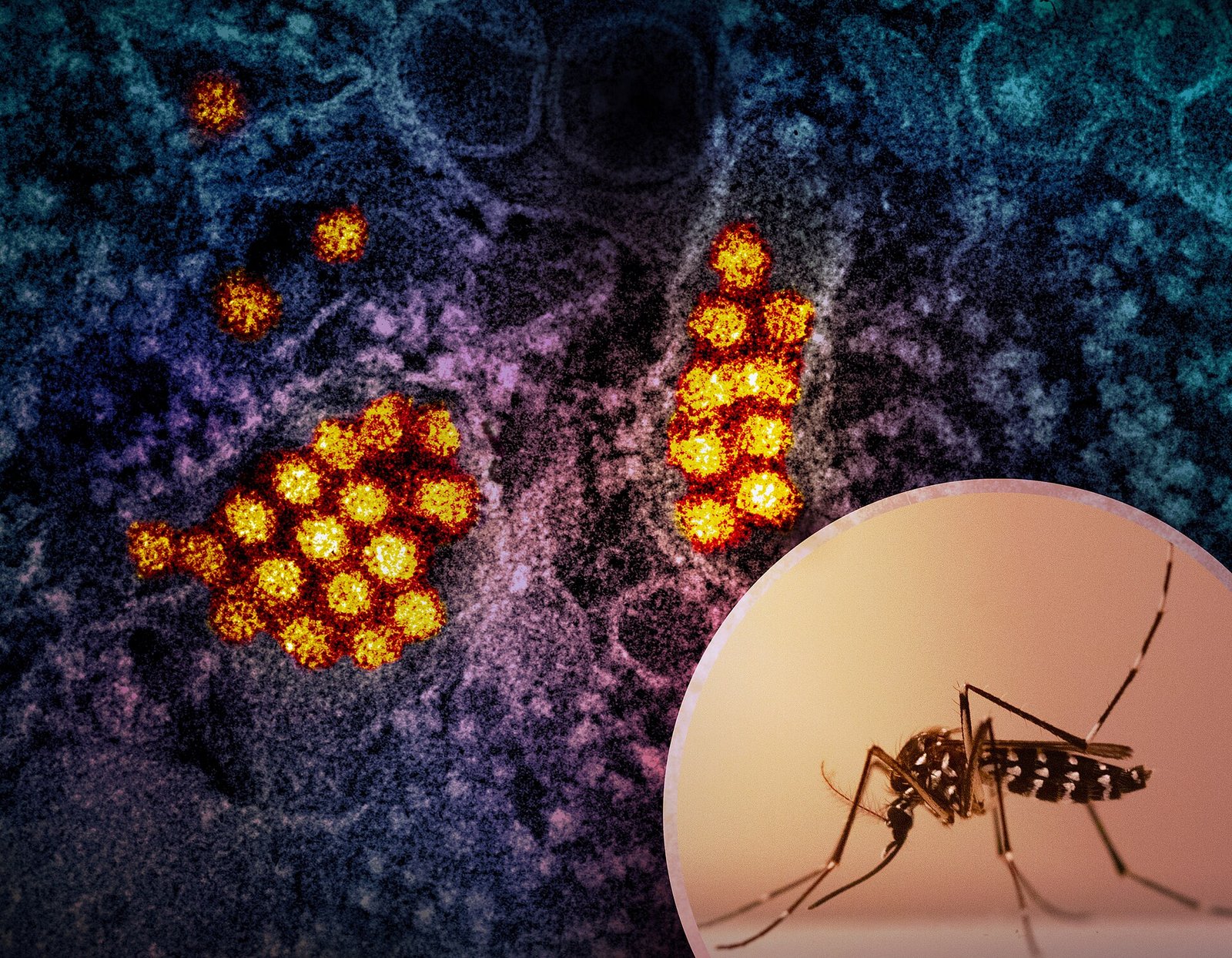 Dengue Fever — recent news image for a rising United States search trend